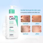 کاهش التهاب و تنظیم چربی پوست با شوینده تخصصی سراوی.