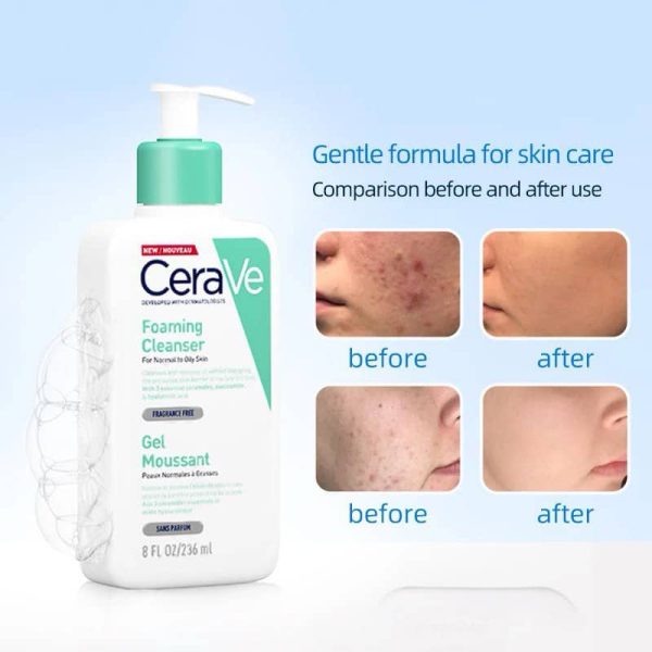 کاهش التهاب و تنظیم چربی پوست با شوینده تخصصی سراوی.